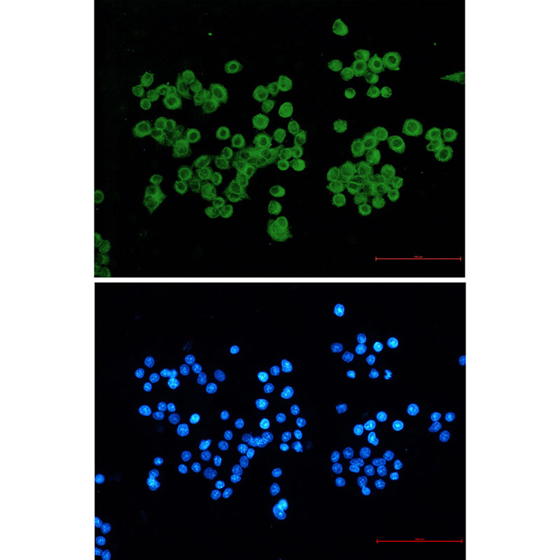 CLIP170 Rabbit mAb