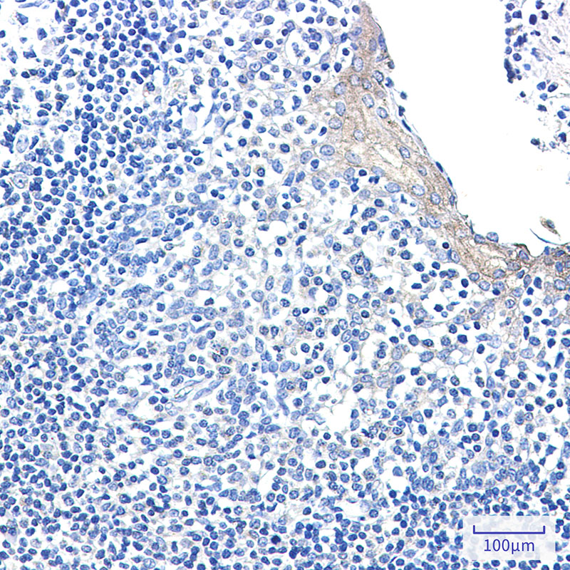 CLIP170 Rabbit mAb