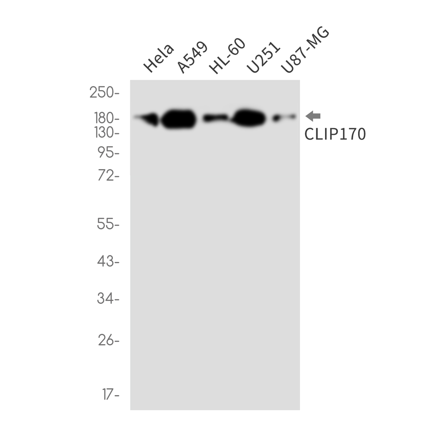 CLIP170 Rabbit mAb
