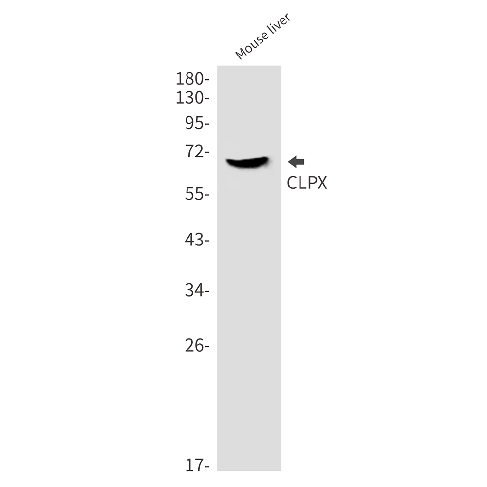 CLPX Rabbit mAb