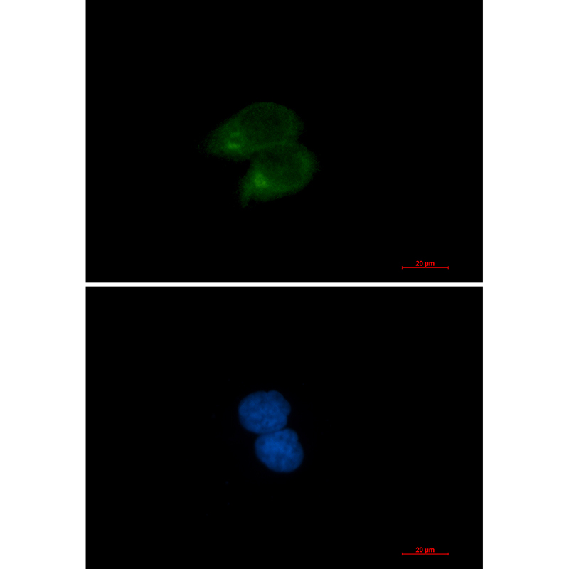 CLSTN1 Rabbit mAb