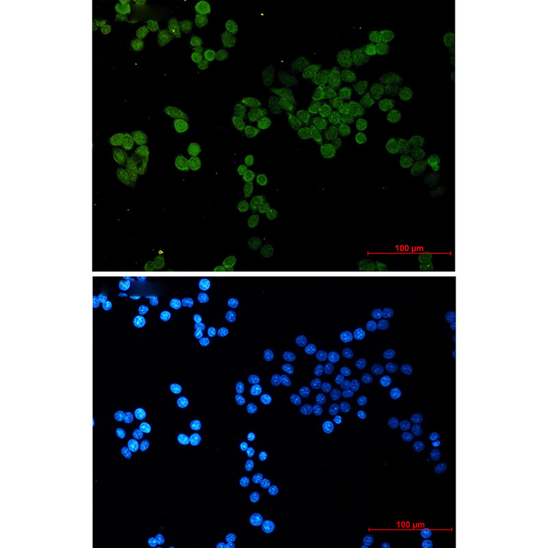 CRCP Rabbit mAb
