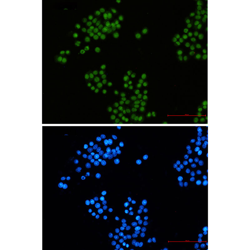 CTBP2 Rabbit mAb
