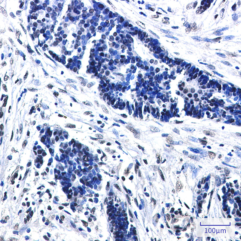 CTBP2 Rabbit mAb