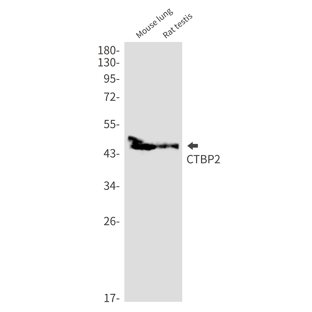 CTBP2 Rabbit mAb