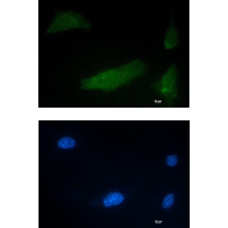 CUG BP1 Rabbit mAb