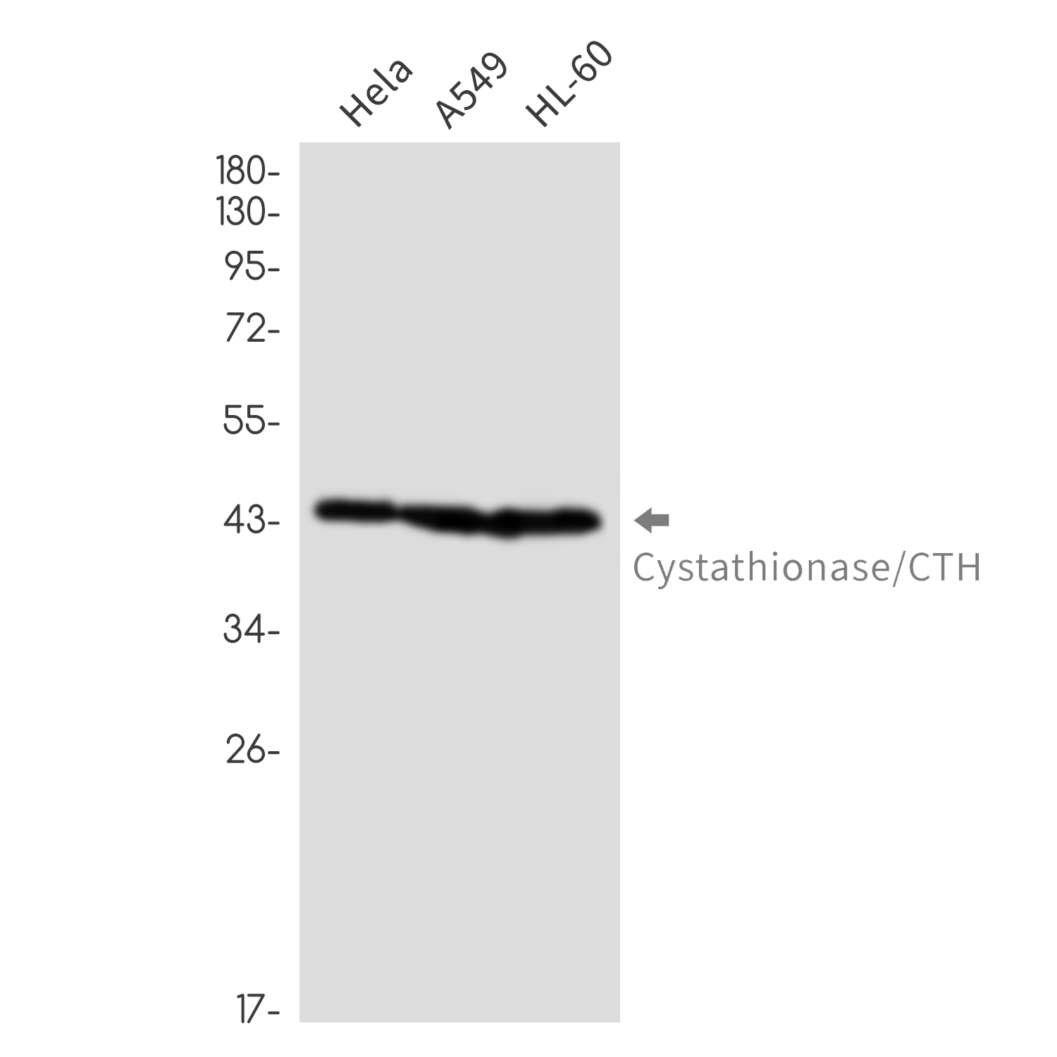 Cystathionase Rabbit mAb