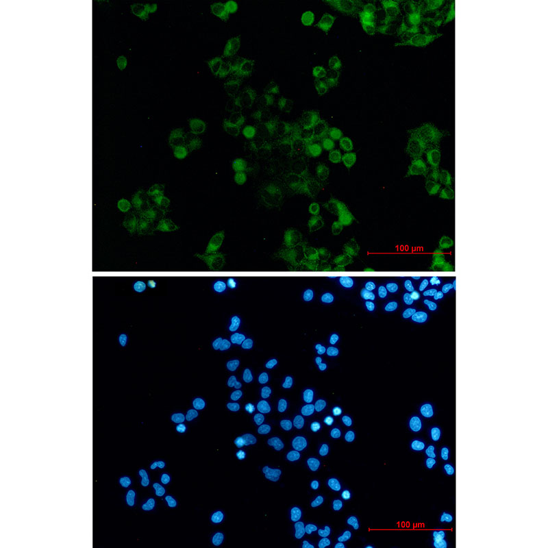 DAB2 Rabbit mAb