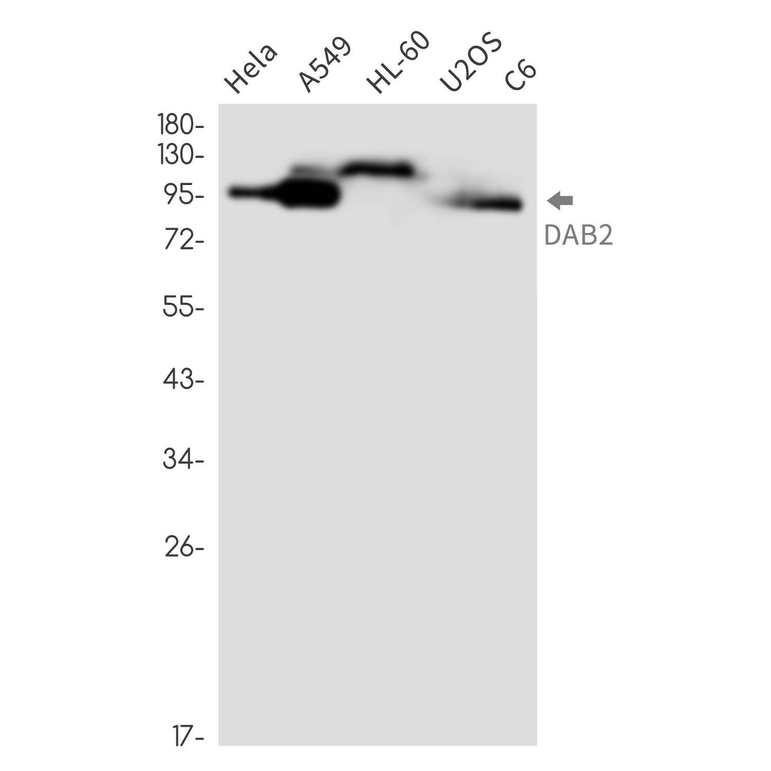 DAB2 Rabbit mAb