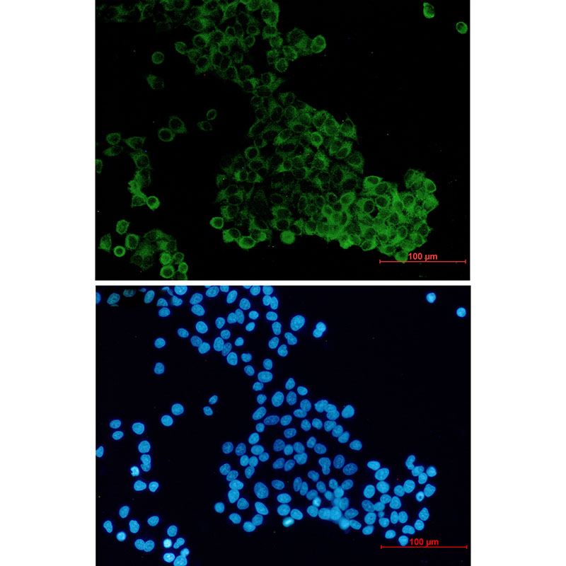 DENN Rabbit mAb
