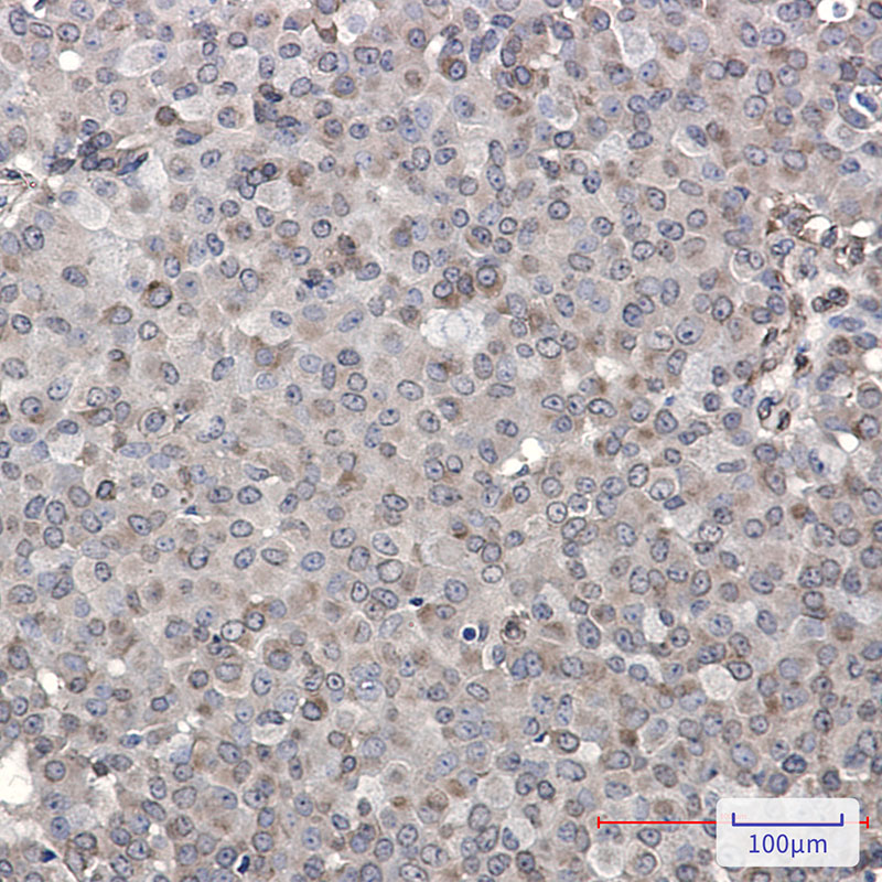 DENN Rabbit mAb