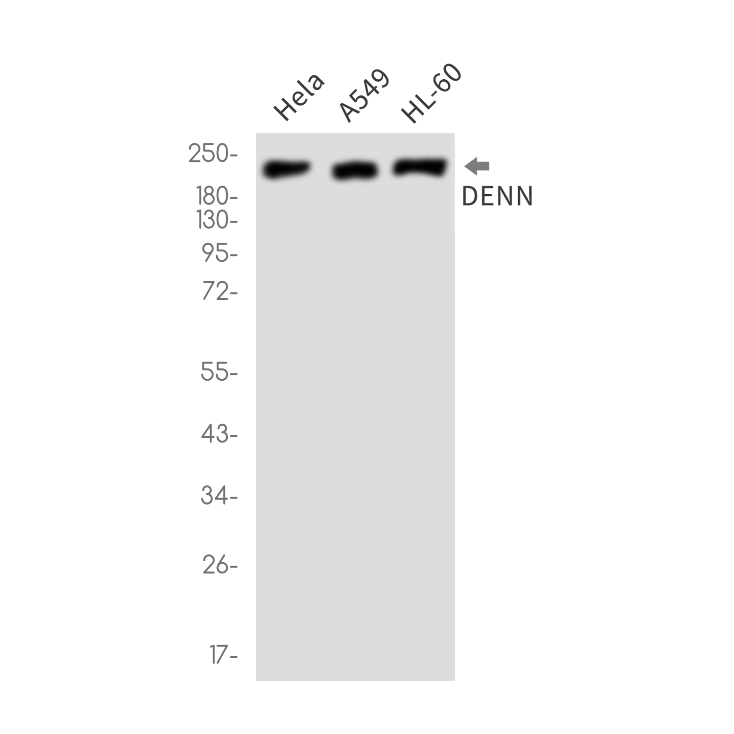 DENN Rabbit mAb