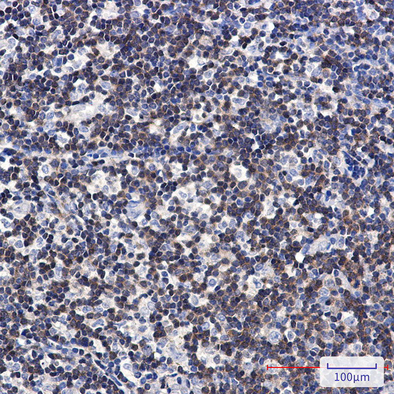 DGKA Rabbit mAb