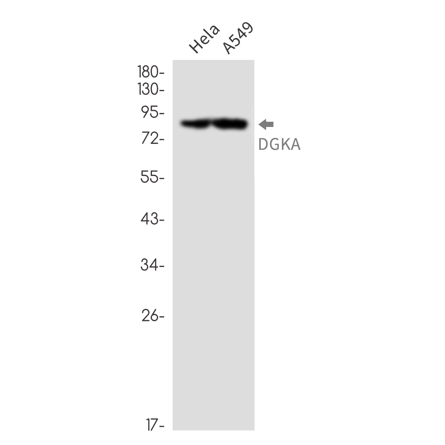 DGKA Rabbit mAb