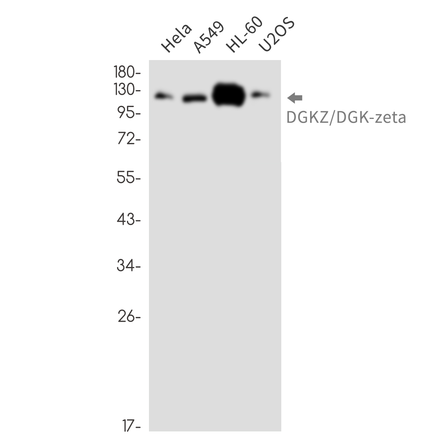 DGKZ Rabbit mAb