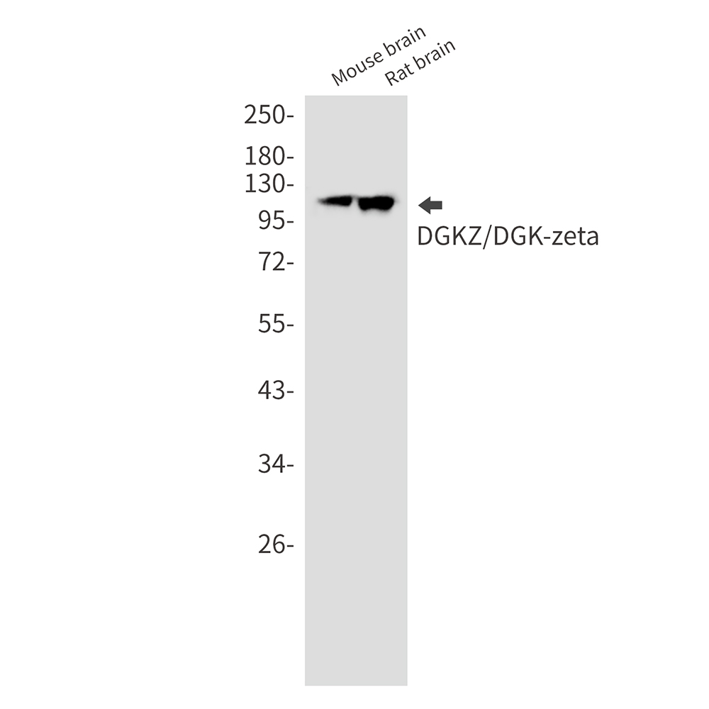 DGKZ Rabbit mAb