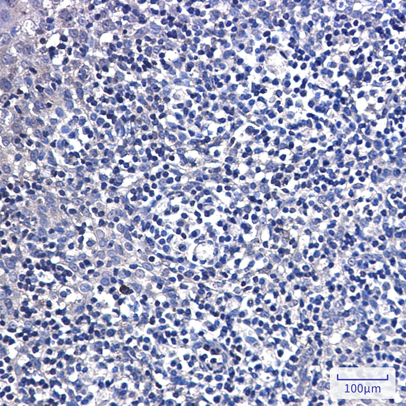 DTYMK Rabbit mAb