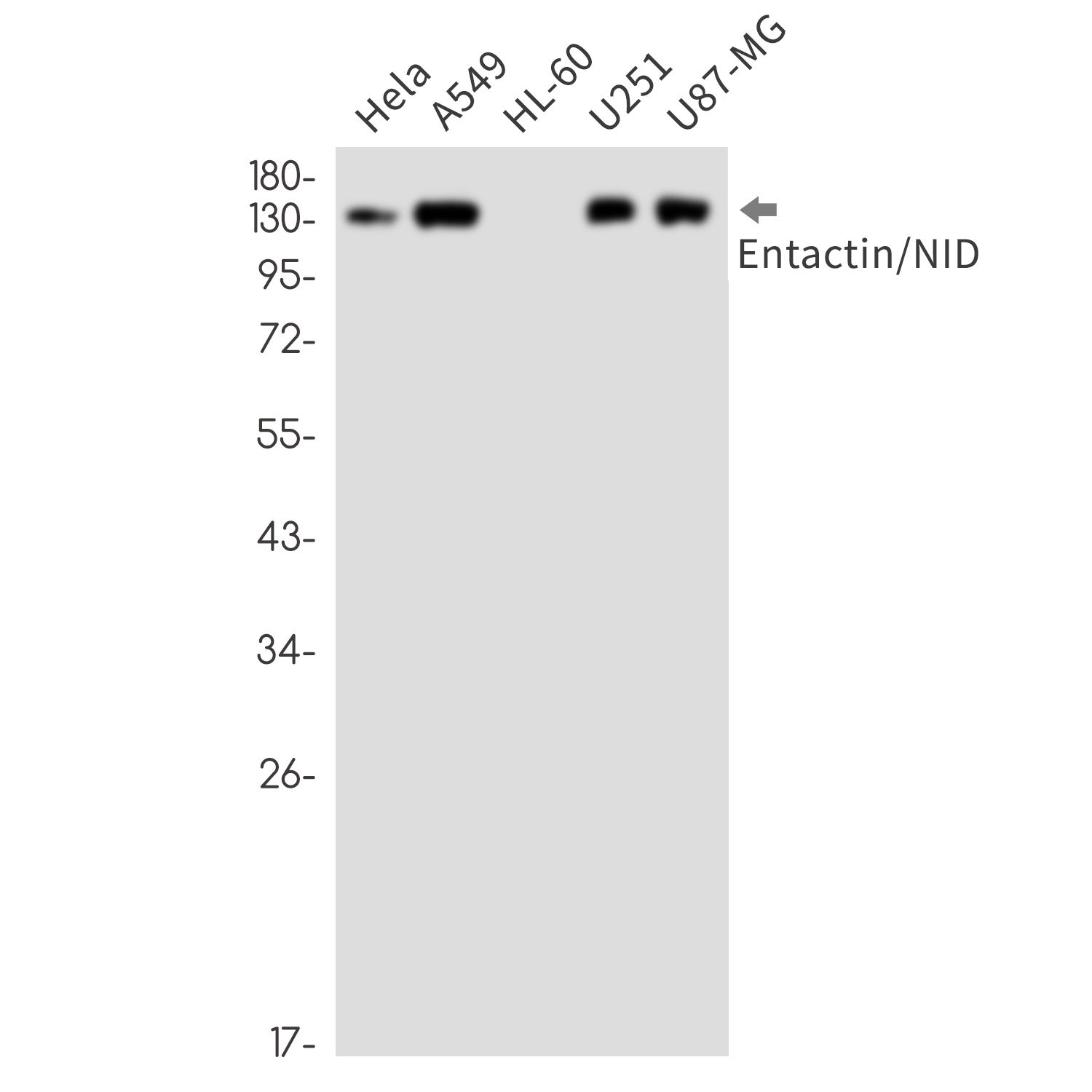 Entactin Rabbit mAb