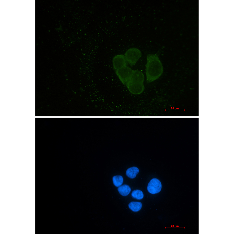 EPS15R Rabbit mAb