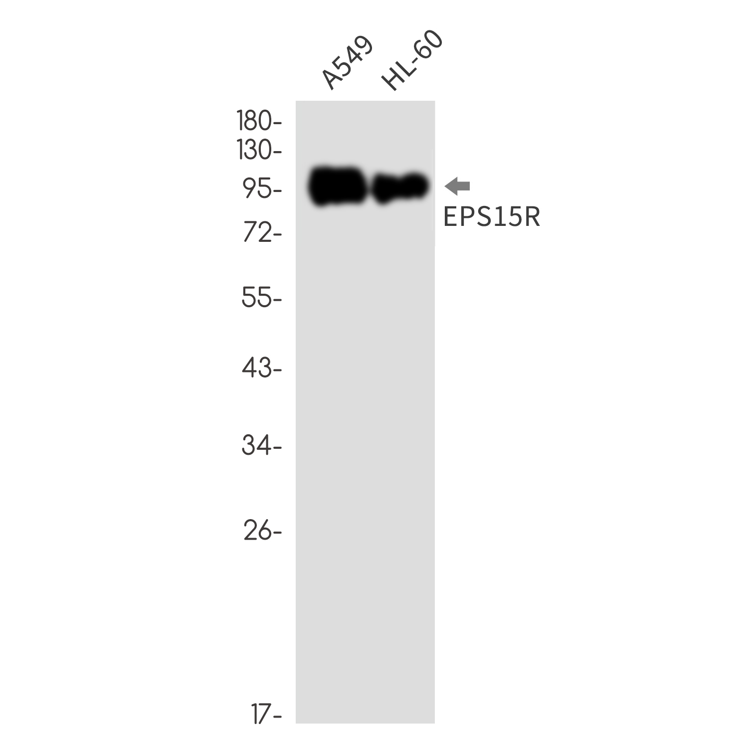 EPS15R Rabbit mAb