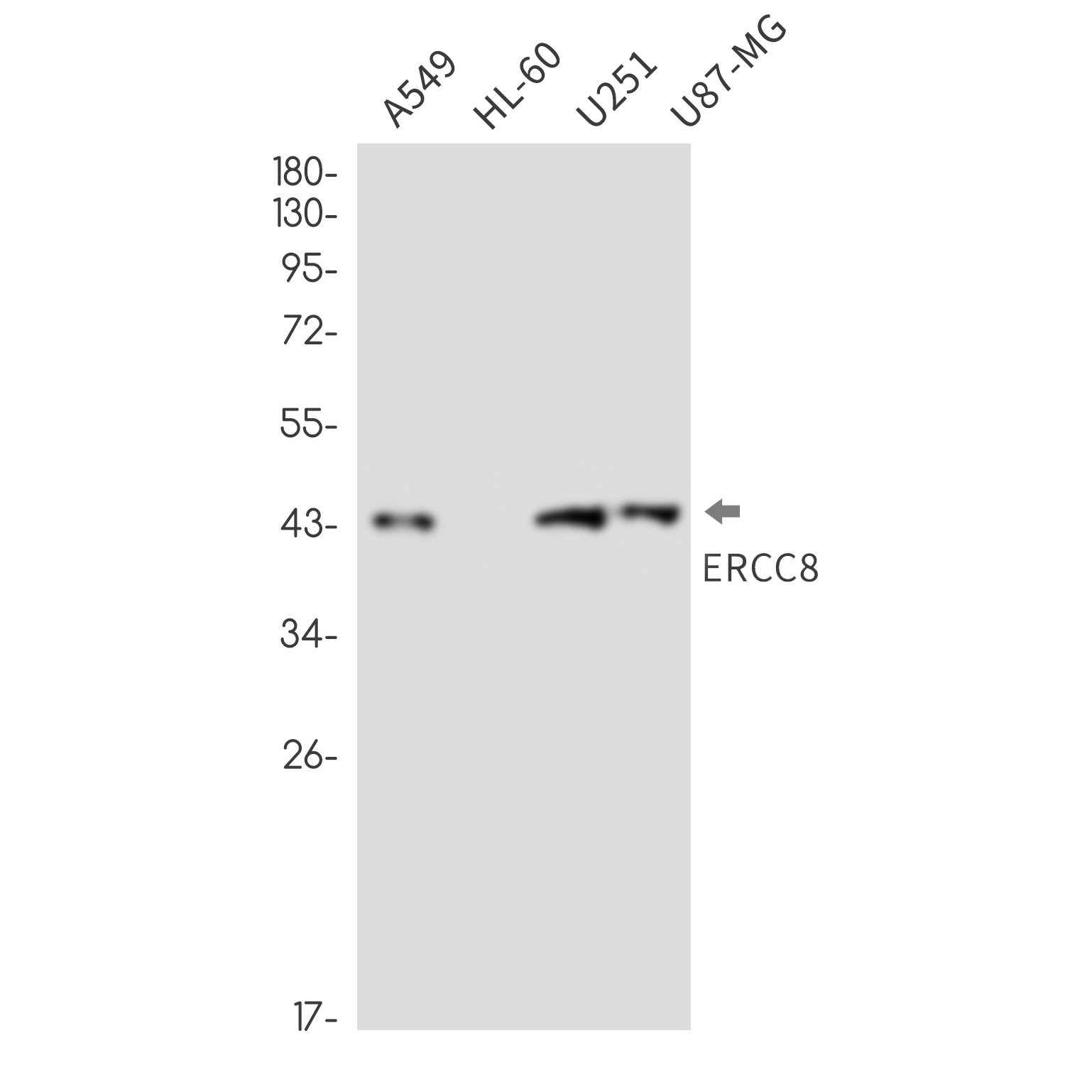 ERCC8 Rabbit mAb
