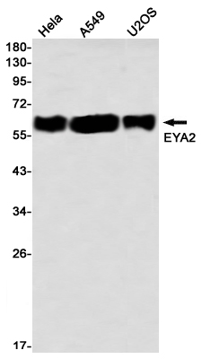 EYA2 Rabbit mAb