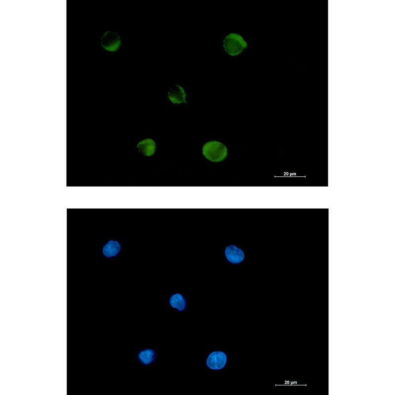 FADS1 Rabbit mAb