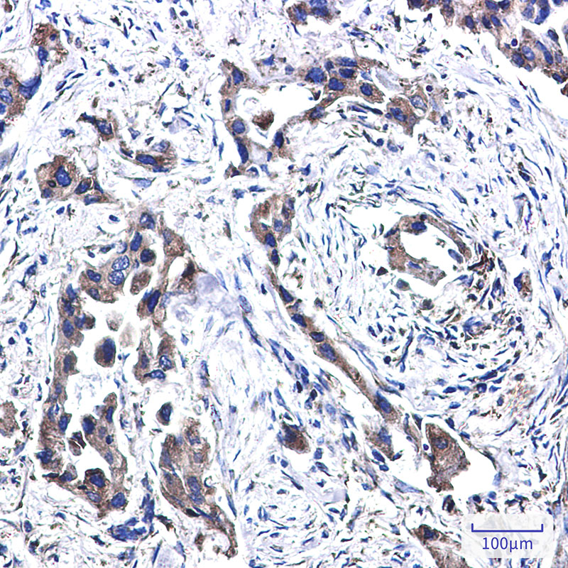 FADS1 Rabbit mAb