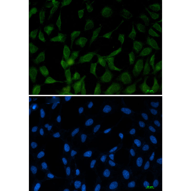 FE65 Rabbit mAb