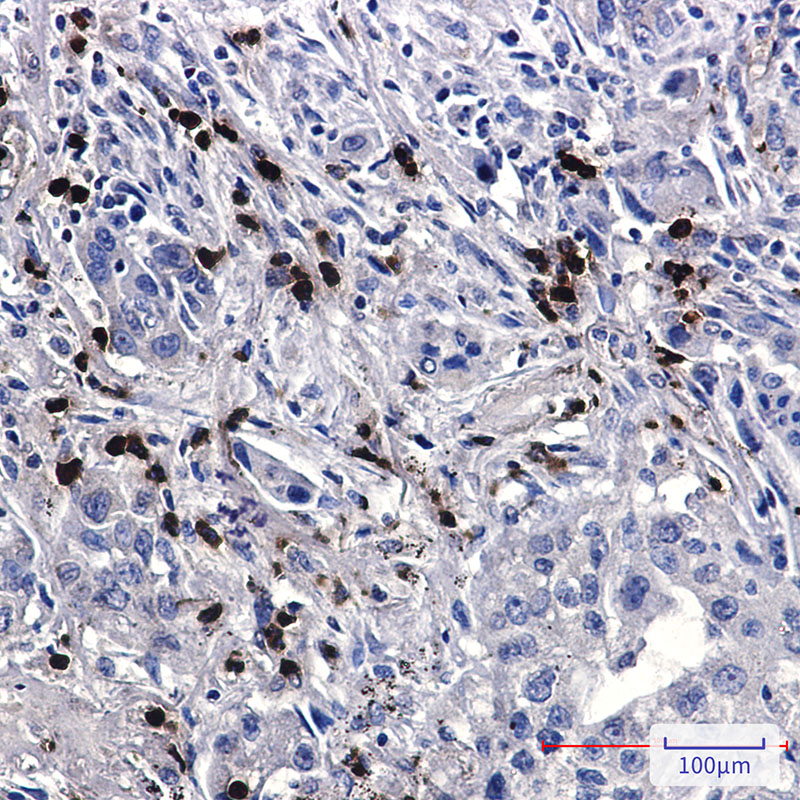 FE65 Rabbit mAb