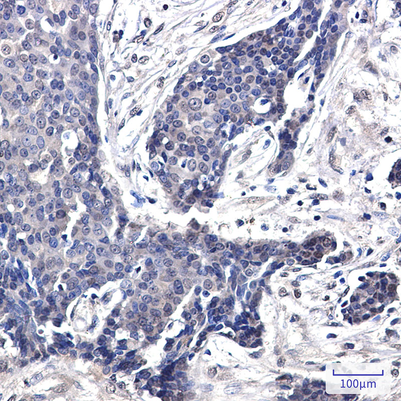 FHL1 Rabbit mAb
