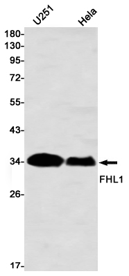 FHL1 Rabbit mAb