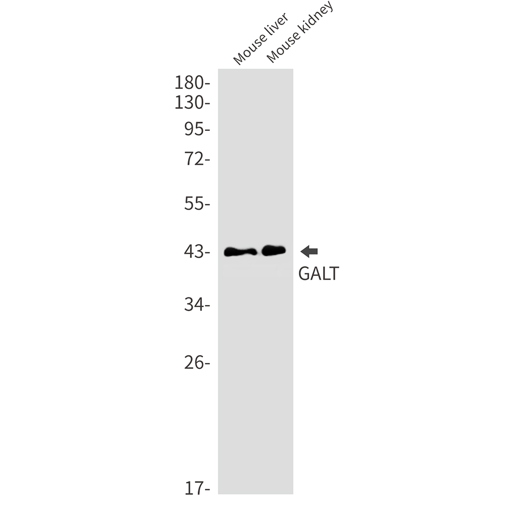 GALT Rabbit mAb