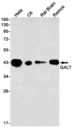 GALT Rabbit mAb