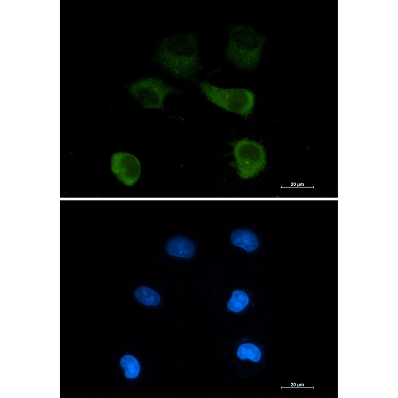 gamma Tubulin Rabbit mAb