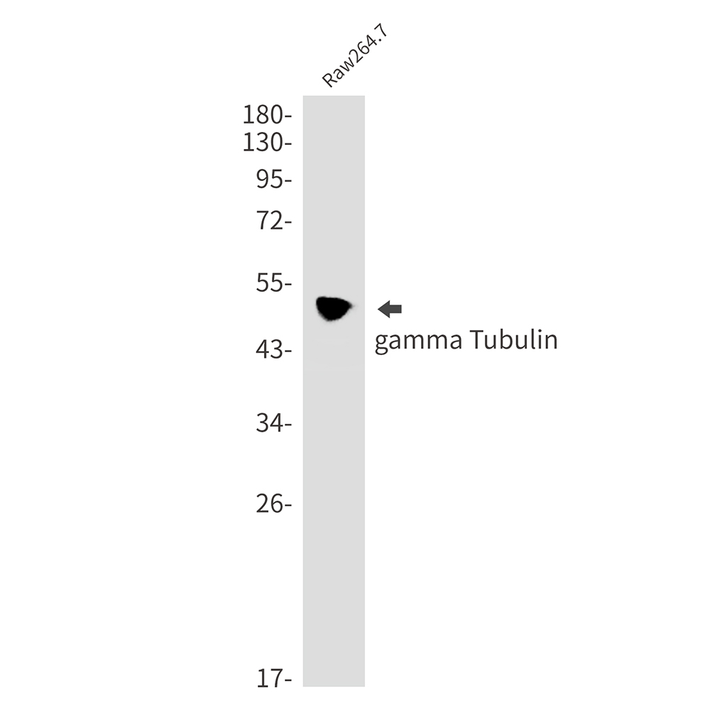 gamma Tubulin Rabbit mAb