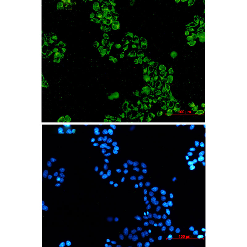GC1q R Rabbit mAb