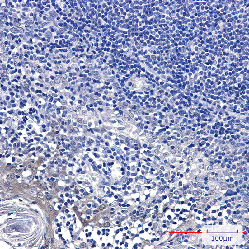 GCLM Rabbit mAb