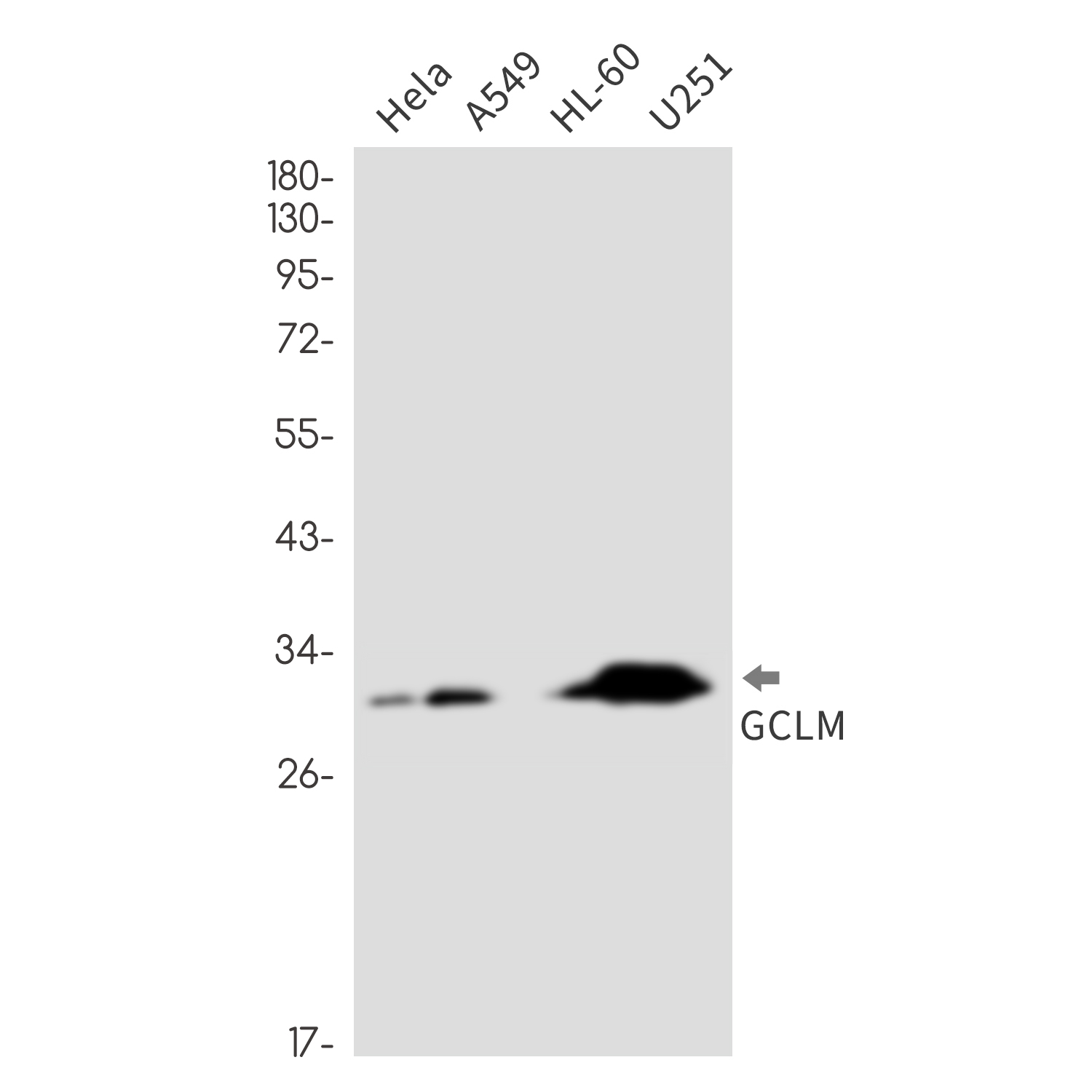 GCLM Rabbit mAb