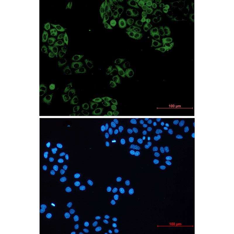 GNAI2 Rabbit mAb