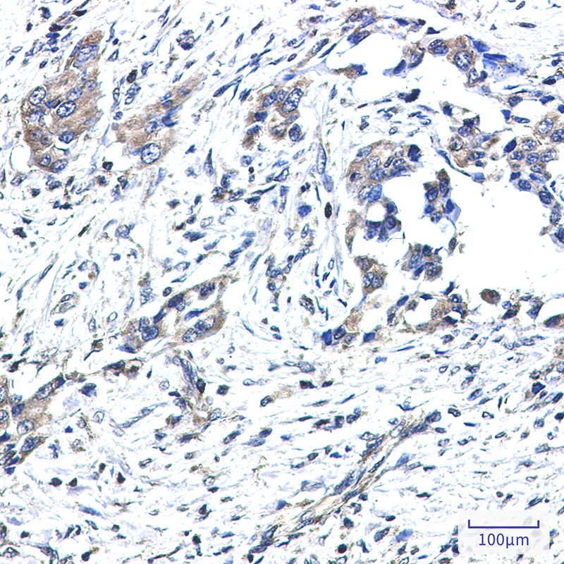 GNAI2 Rabbit mAb