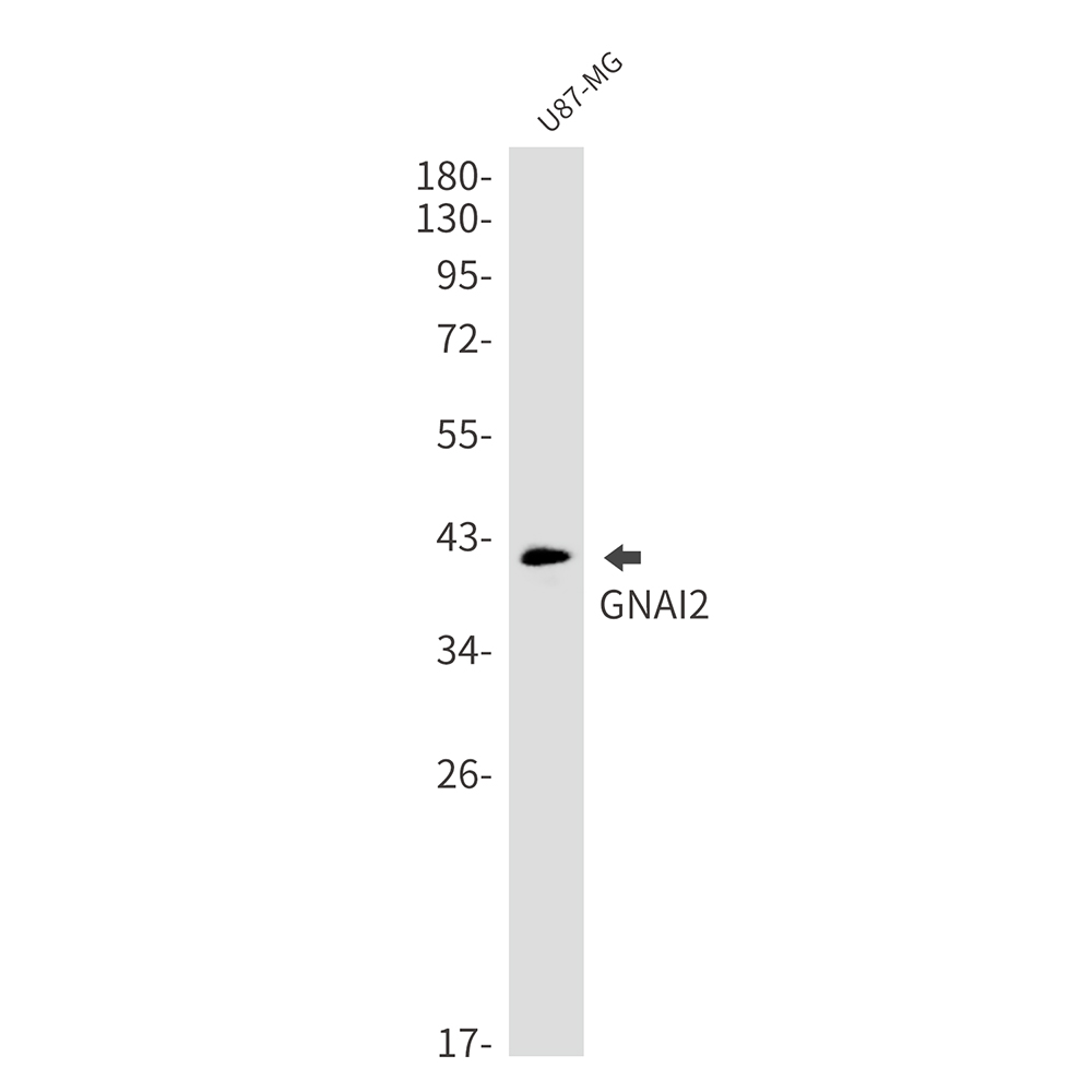 GNAI2 Rabbit mAb