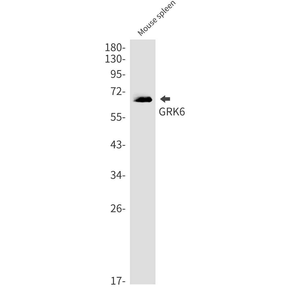 GRK6 Rabbit mAb