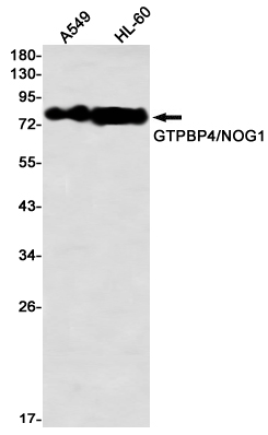 GTPBP4 Rabbit mAb