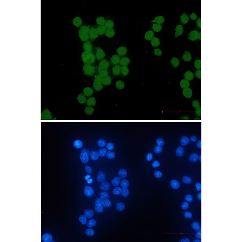 HIPK2 Rabbit mAb