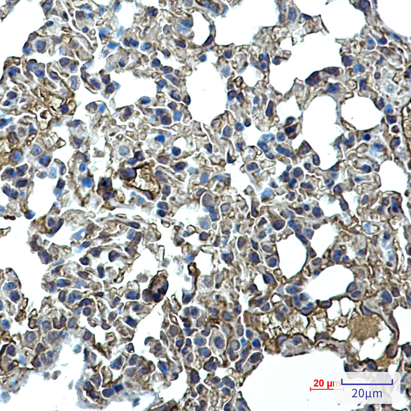 ICAM2 Rabbit mAb