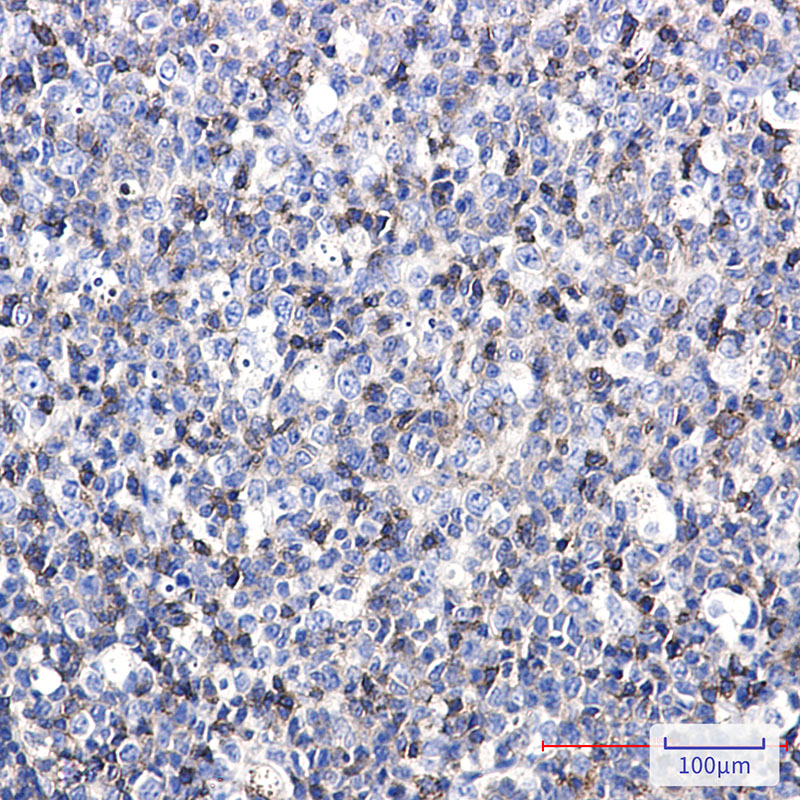 ICAM3 Rabbit mAb