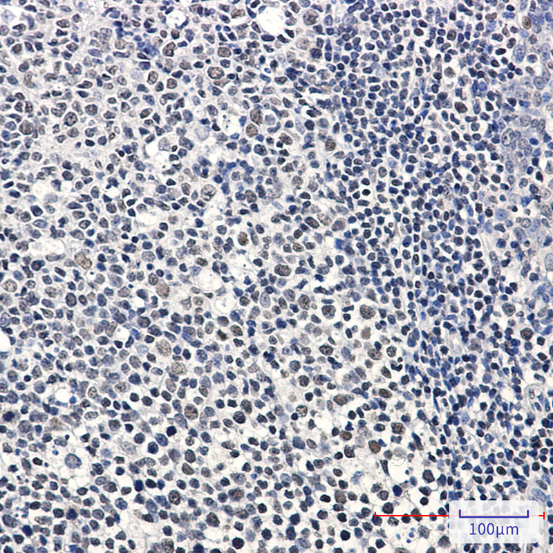 IKZF3 Rabbit mAb