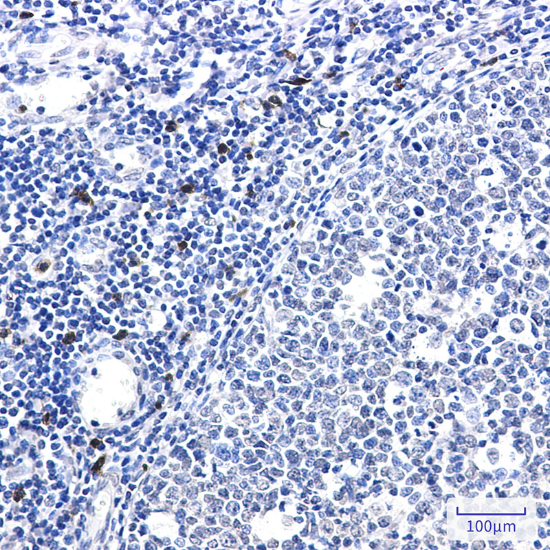 IL-26 Rabbit mAb