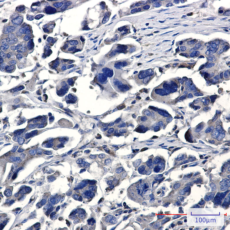 IQGAP2 Rabbit mAb